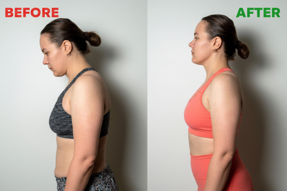 Before and After Posture Comparison